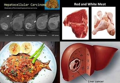 hepatocellular carcinoma and meat consumption.jpg