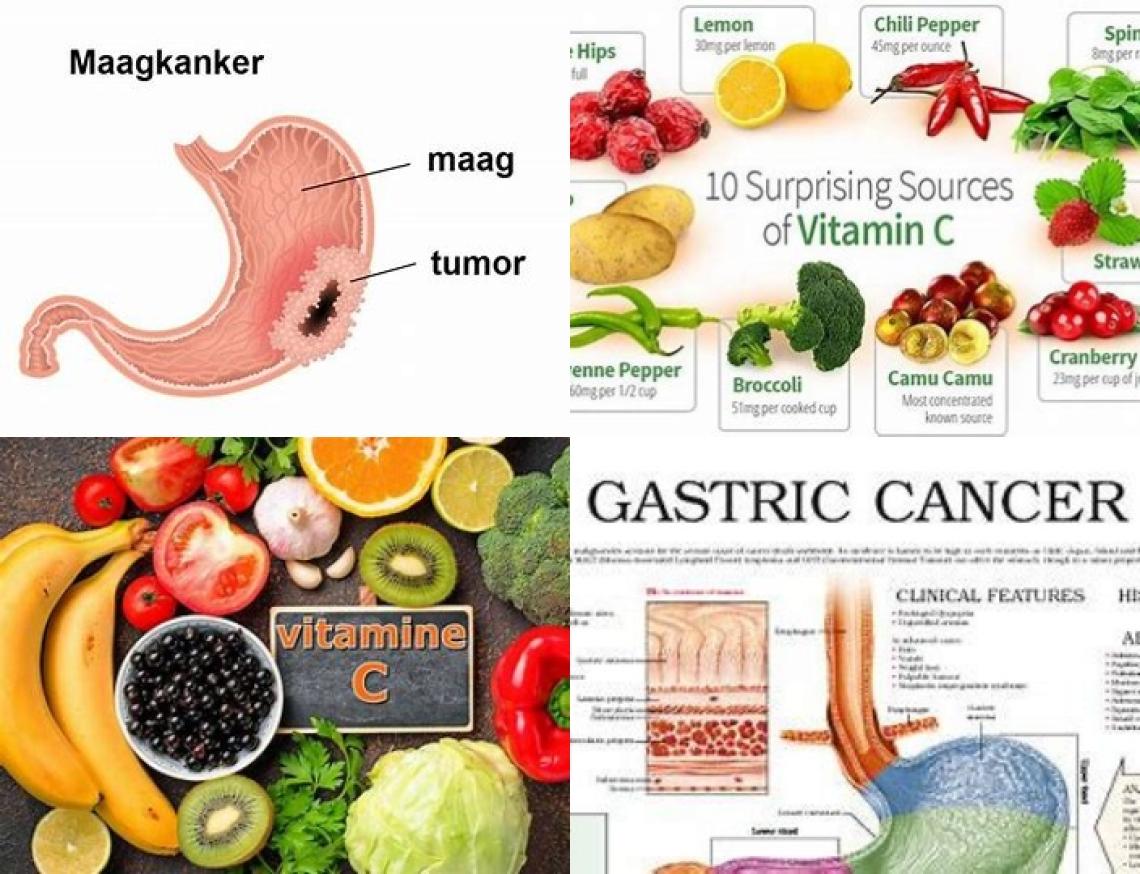 Vitamine C en maagkanker