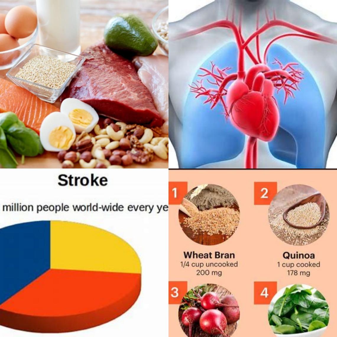 Stroke mortality and betaine 