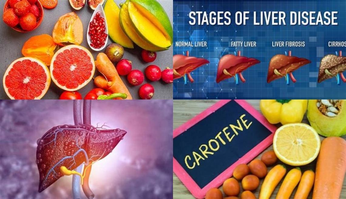 Carotenoids and liver disease